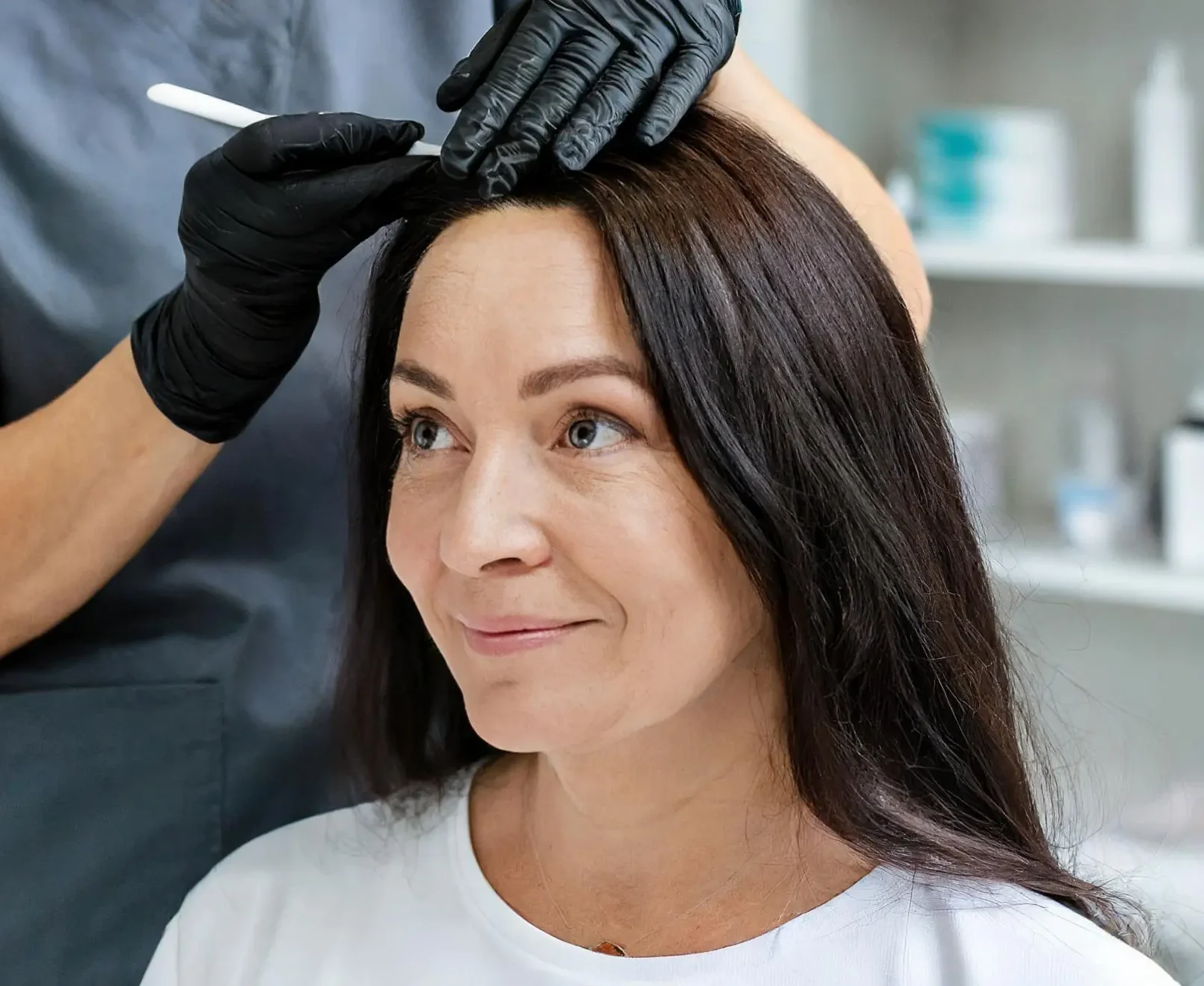 hair transplant surgery for women