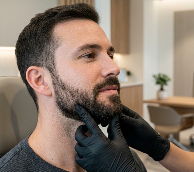 Beard Transplant