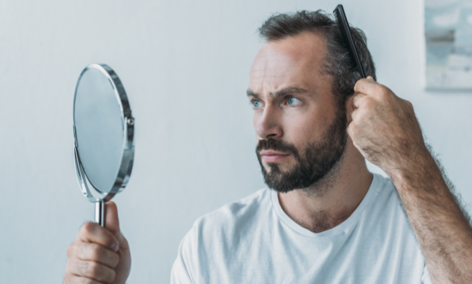 Hair Transplant Growth Timeline: What to Expect Month by Month