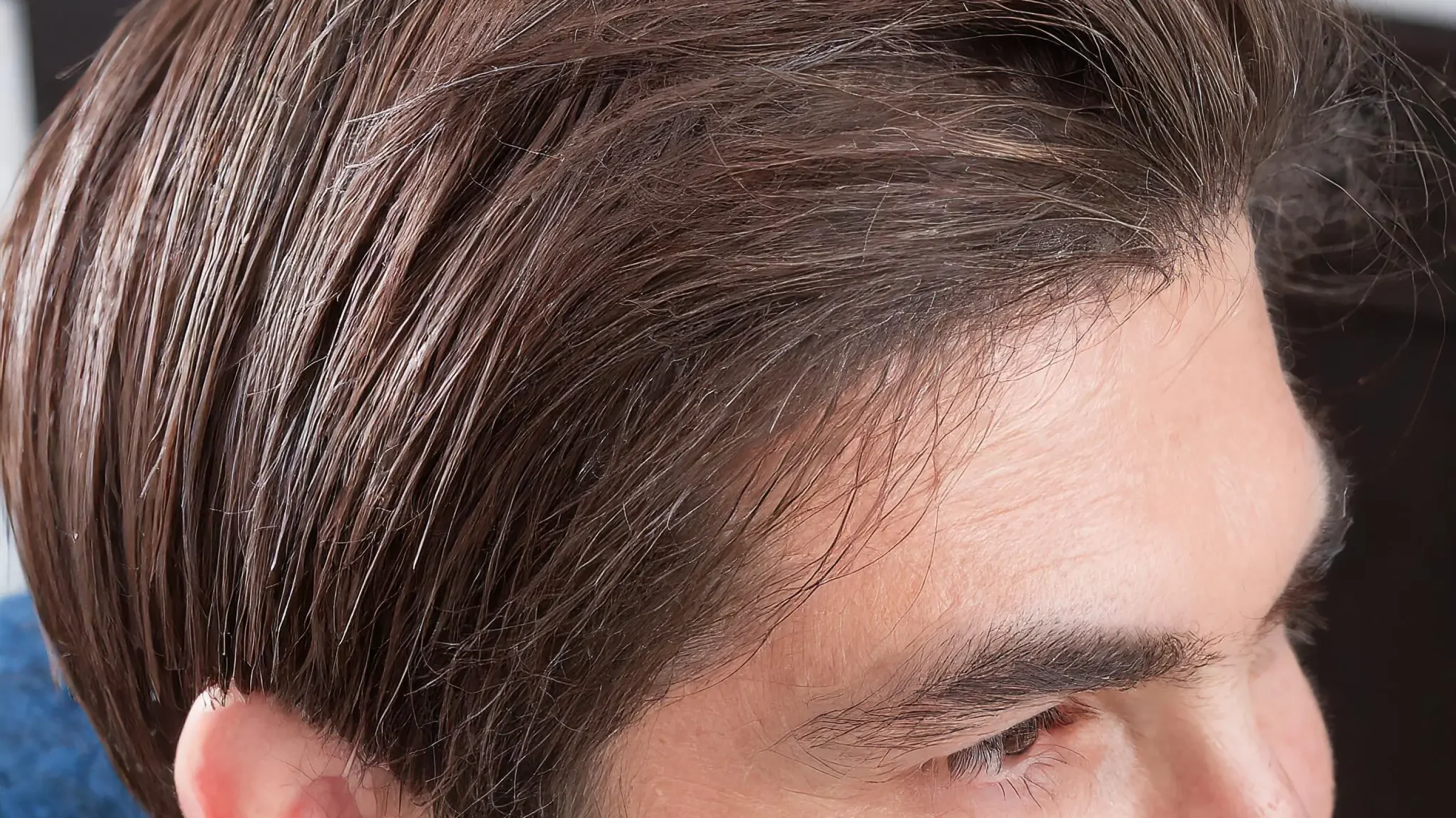 Hair Transplant Technology